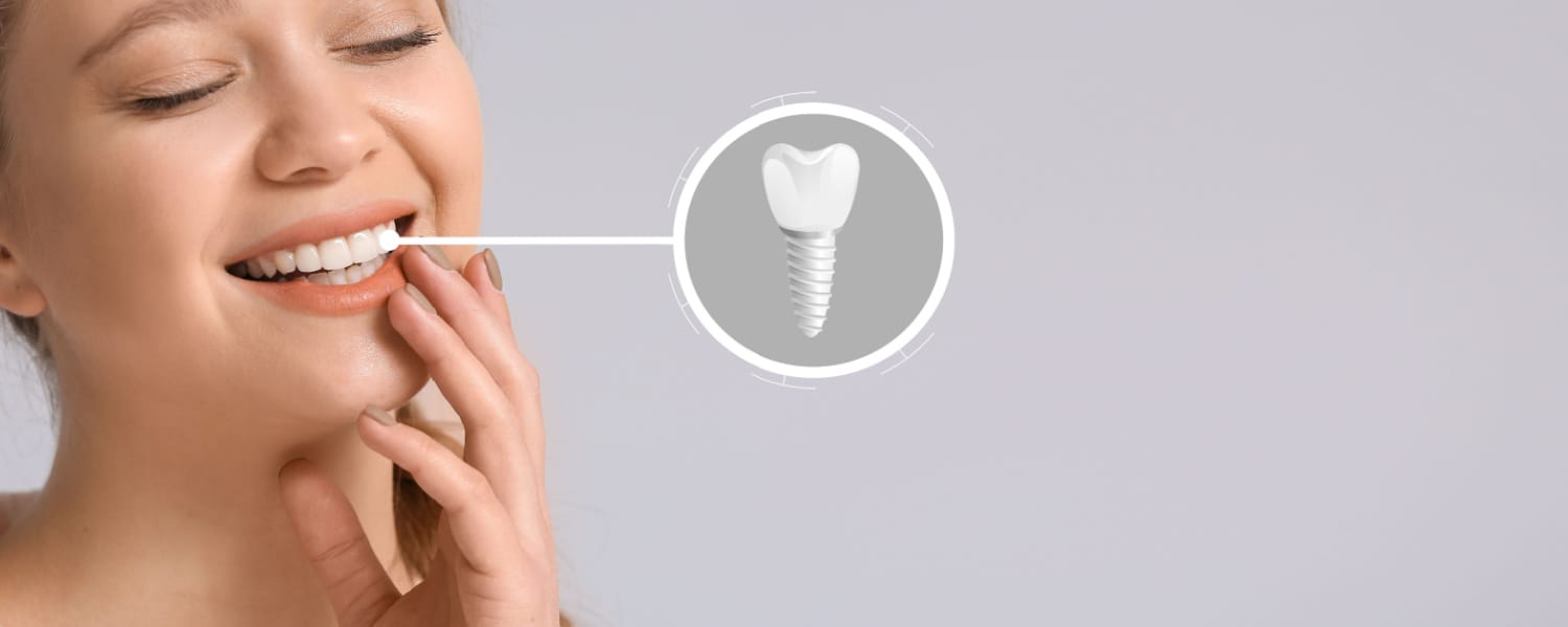 Dental Implant Geneva IL