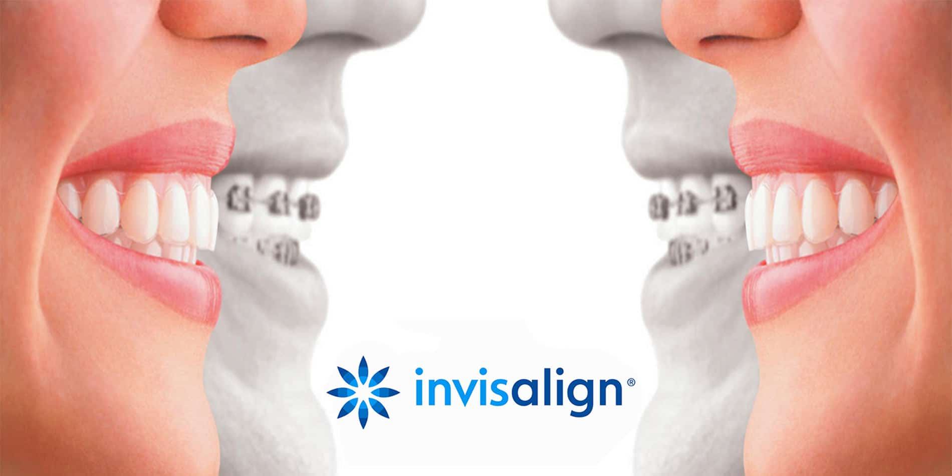 All About You Dental Care