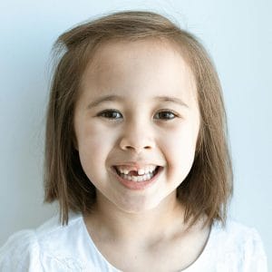 A little girl smiling showing that she has lost some baby teeth. 