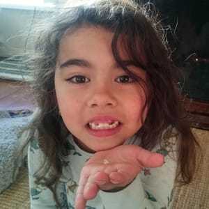 A little girl holding her tooth that just came out