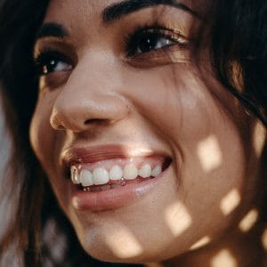 woman smiling showing her entire visible dental anatomy on several teeth